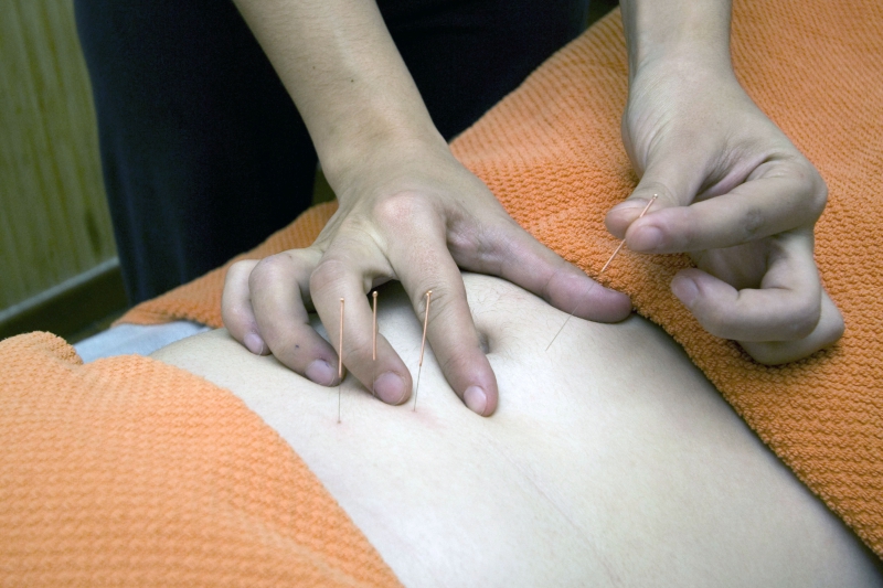 osteopathe-OPIO-min_acupuncture-4175625